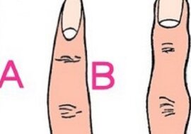 Zaskakujące, jakie cechy charakteru zdradza. Co mówi o tobie kształt małego palca?