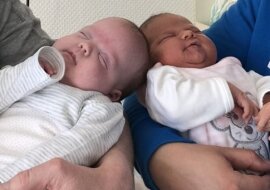 Te bliźniaki urodziły się z różnicą trzech miesięcy i stały się prawdziwym przełomem w świecie naukowym