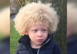 5-letni albinos nie lubił swojego wyglądu, dopóki nie znalazł pewności siebie dzięki modelingu