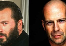 9 zdjęć znanych aktorów, zanim zaczęli łysieć