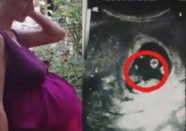 Gdy trafiła na oddział położniczy, lekarze bali się jej dotknąć. Czegoś takiego nigdy dotąd nie widzieli