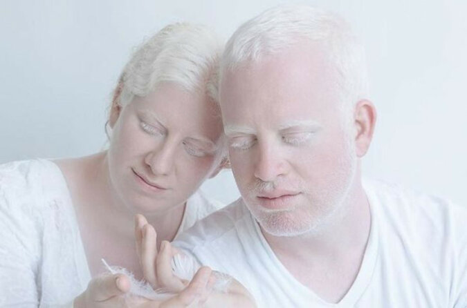Niezwykle piękne albinosy w projekcie fotograficznym „Porcelain Beauty”