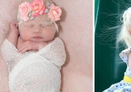 Kilka lat temu w meksykańskiej rodzinie urodziła się dziewczynka o blond włosach. Jak wygląda teraz dziecko?