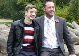 Mężczyzna zebrał 100 tysięcy funtów brytyjskich dla chłopca, który ma poważną wadę twarzy