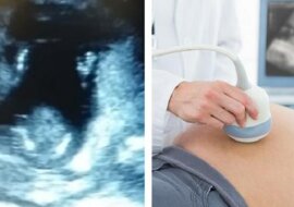 Ciężarna kobieta wybrała się na badanie. Zachowanie dziecka na USG zaskoczyło lekarzy