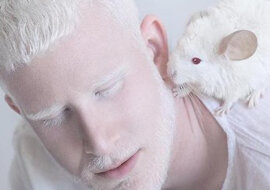 Porcelanowe piękno: niesamowite zdjęcia albinosów