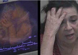 Kiedy zobaczyła nagranie usg swojego wnuka, przeżyła przerażenie. Nie uwierzycie, co robiło dziecko