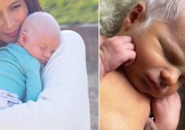 Jak wygląda teraz chłopiec, który urodził się 8 lat temu z siwymi włosami jak u starszych ludzi