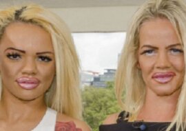 Matka i córka wydały 250 tys. złotych, aby upodobnić się do siebie. Wciąż nie są zadowolone