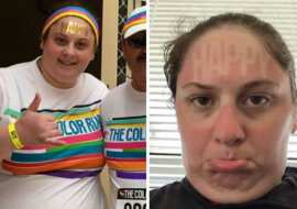 10 „zabójczych” zdjęć o tym, jak nie należy się opalać