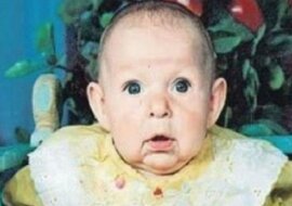 Ojciec porzucił córkę, gdy zobaczył jej twarz. 22 lata później ona pokazała światu, że piękno tkwi wewnątrz nas