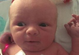 Lekarze wykonali cesarskie cięcie, oczekując najgorszego. Kiedy urodziło się dziecko, nie mogli uwierzyć własnym oczom