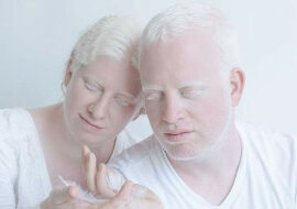 Niezwykle piękne albinosy w projekcie fotograficznym „Porcelain Beauty”